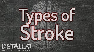 Stroke Pathophysiology Ischaemic VS Haemorrhagic TIAs Signs and Symptoms Treatments [upl. by Susanne]