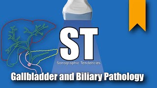 Gallbladder and Biliary Pathology [upl. by Anaynek]