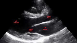 Echocardiogram Parasternal Long Axis View  Loop [upl. by Orecic]