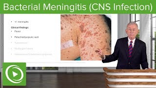 Bacterial Meningitis CNS Infection – Infectious Diseases  Lecturio [upl. by Odnamla]