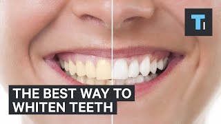 The best way to whiten teeth [upl. by Eilema]