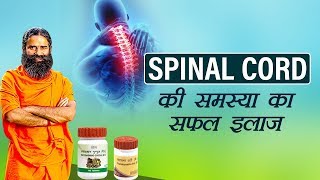 Ayurvedic Treatment for Spinal Cord  Swami Ramdev [upl. by Yttocs]