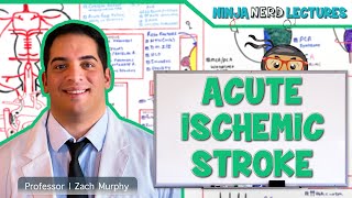 Types of Ischaemic Stroke  Oxford Bamford Classification  Details [upl. by Gwynne]