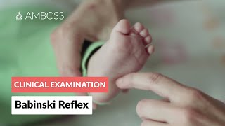 Babinski Reflex in Infants  Clinical Examination [upl. by Lemuela]