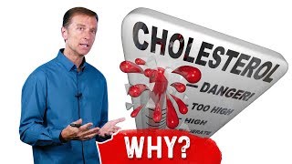 Why Do You Get High Cholesterol After Intermittent Fasting – DrBerg [upl. by Einahets]