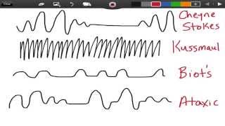 How to do the Tummo Breathing [upl. by Yehsa183]