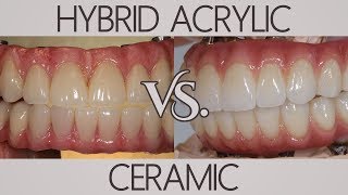 Whats the difference between acrylic and ceramic  Patients Ask [upl. by Fairley]