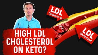 Why High LDL Cholesterol on the Ketogenic Diet – Dr Berg [upl. by Lancey]