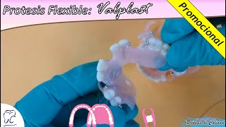 Prótesis Removible Flexible Valplast [upl. by Garry419]