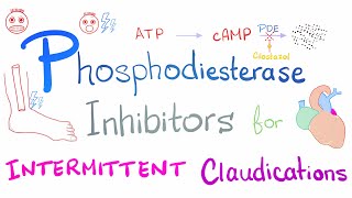 Intermittent Claudications Management [upl. by Sander]