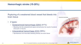 Ischemic and Hemorrhagic Strokes  High Yield [upl. by Notgnimer]