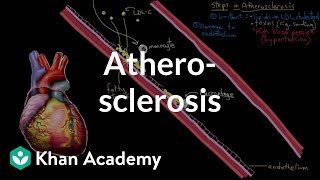 Atherosclerosis  Circulatory System and Disease  NCLEXRN  Khan Academy [upl. by Aicened]