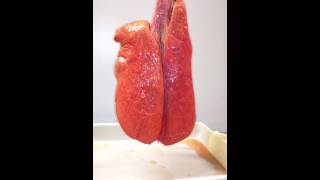 Smokers Lungs VS Nonsmokers Lungs [upl. by Ahtebat447]