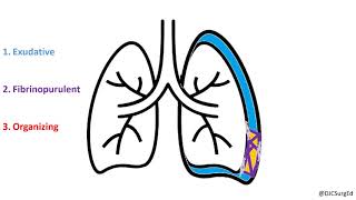 Pleura  Pleural Cavity anatomy [upl. by Casi]