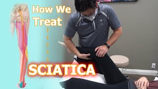 How We Treat Sciatica  Physical Therapy [upl. by Noisla]