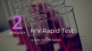 HIV Rapid Test [upl. by Leatri568]