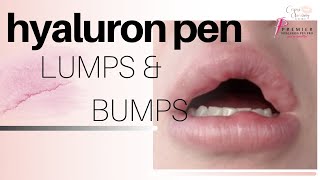 Filler Lumps and Bumps  Hyaluron Pen [upl. by Henryson]