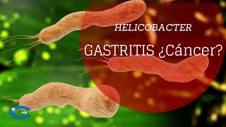 Helicobacter principal causa de gastritis y posiblemente de cáncer [upl. by Aicelav455]