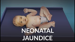 Neonatal Jaundice by L Veit  OPENPediatrics [upl. by Verlie]