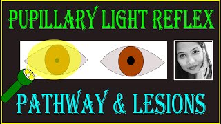 Pupillary Light Reflex – Pathway amp Lesions  Neuro ophthalmology [upl. by Aikrahs]