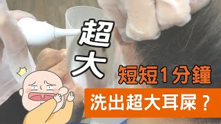 【診所洗耳患者】短短1分鐘竟然清洗出quot魔王級quot耳屎，驚訝到護士措手不及 [upl. by Mad612]