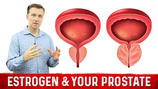 How To Fix Enlarged Prostate Explained By Dr Berg [upl. by Eirrotal322]