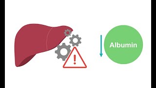 Getting to know albumin physiology [upl. by Nicolea224]