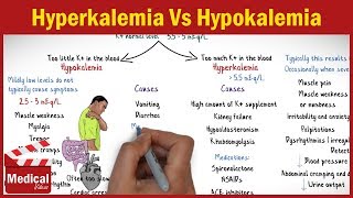 Hyperkalemia Vs Hypokalemia  EASY TO REMEMBER [upl. by Ykcim]