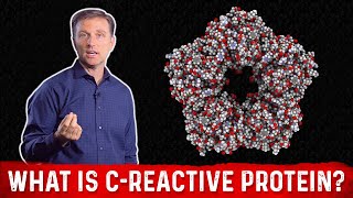 What is CReactive Protein amp How to Lower it – Dr Berg [upl. by Eussoj]