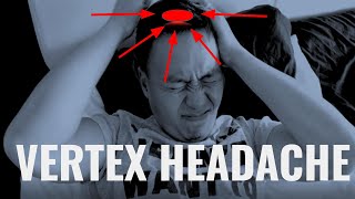 How to relieve top of the head headache  Vertex Headache CHECK THIS MUSCLE [upl. by Chirlin]