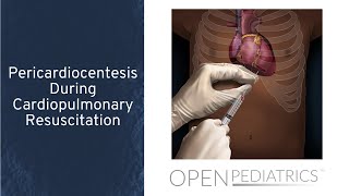 Pericardiocentesis During Cardiopulmonary Resuscitation by T Wolbrink  OPENPediatrics [upl. by Alue]