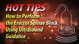 How to Perform the Erector Spinae Block Using Ultrasound Guidance [upl. by Stan]