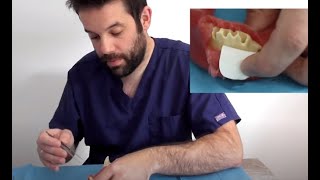 Video tutorial Membrana OsteoBiol Evolution Dual Pins y Sutura Seralon Dr Carlos Pascual [upl. by Cullan881]