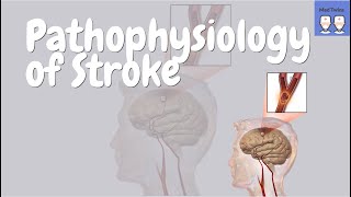 Acute Ischemic Stroke  Signs and Symptoms Stroke Syndromes  Causes amp Mechanisms  Treatment [upl. by Debi329]